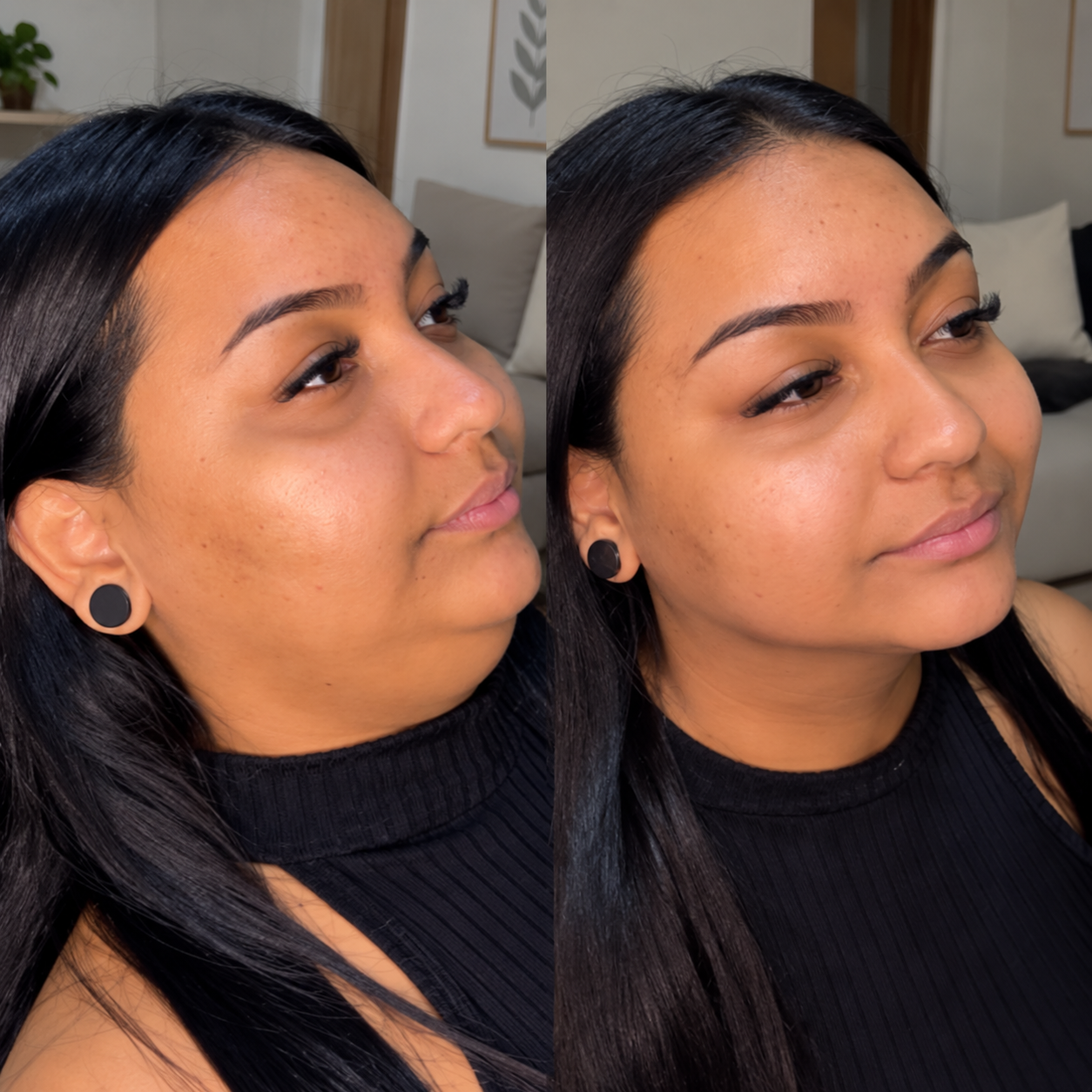 Antes e depois